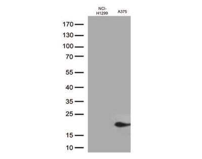 Western Blot: CTAG1B Antibody (OTI2B6)Azide and BSA Free [NBP2-70485]