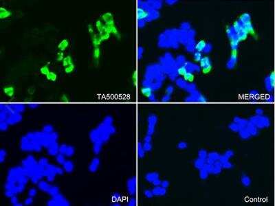Immunocytochemistry/ Immunofluorescence: CTAG1B Antibody (OTI2B6) [NBP1-47714]