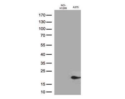 Western Blot: CTAG1B Antibody (OTI2B6) [NBP1-47714]