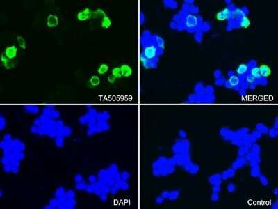 Immunocytochemistry/ Immunofluorescence: CTAG1B Antibody (OTI5H4) - Azide and BSA Free [NBP2-70486]