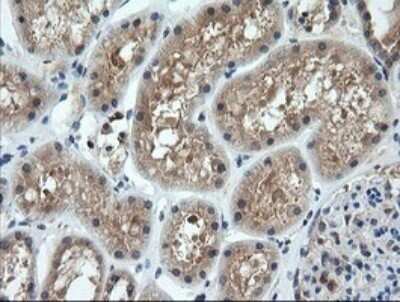 Immunohistochemistry: CTAG1B Antibody (OTI5H4) - Azide and BSA Free [NBP2-70486]