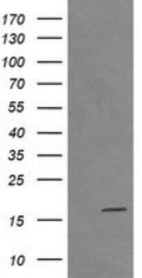 Western Blot: CTAG1B Antibody (OTI5H4)Azide and BSA Free [NBP2-70486]