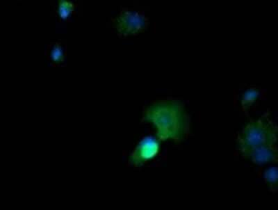 Immunocytochemistry/ Immunofluorescence: CTAG1B Antibody (OTI5H4) [NBP2-46386]