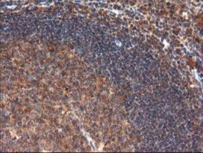 Immunohistochemistry: CTAG1B Antibody (OTI5H4) [NBP2-46386]