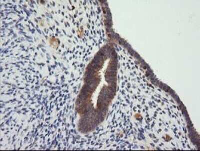 Immunohistochemistry: CTAG1B Antibody (OTI5H4) [NBP2-46386]