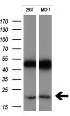 Western Blot: CTAG1B Antibody (OTI5H4) [NBP2-46386]
