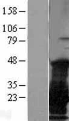 Western Blot: CTAG1B Overexpression Lysate [NBL1-09562]