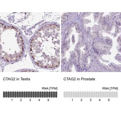 Immunohistochemistry-Paraffin: CTAG2 Antibody [NBP2-49659]