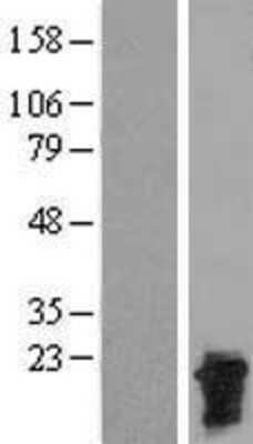 Western Blot: CTAG2 Overexpression Lysate [NBP2-05158]