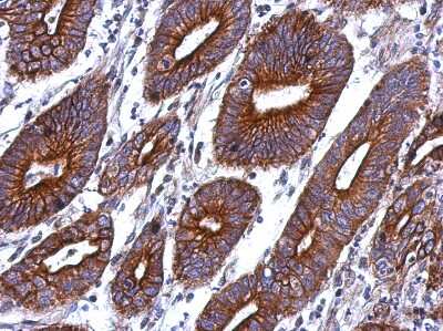 Immunohistochemistry-Paraffin: CTAGE1 Antibody [NBP2-14921]