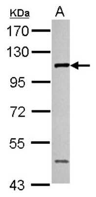 Western Blot: CTAGE1 Antibody [NBP2-14921]