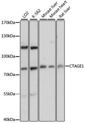 Western Blot: CTAGE1 AntibodyAzide and BSA Free [NBP2-92113]