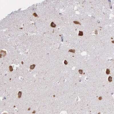 Immunohistochemistry-Paraffin: CTAGE5 Antibody [NBP1-85390]