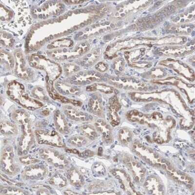 Immunohistochemistry-Paraffin: CTAGE5 Antibody [NBP1-85391]