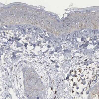 Immunohistochemistry-Paraffin: CTAGE5 Antibody [NBP1-85391]