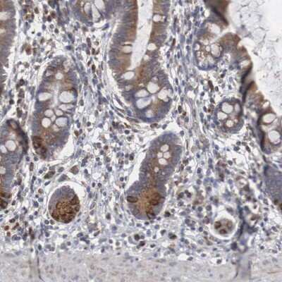 Immunohistochemistry-Paraffin: CTAGE5 Antibody [NBP1-85391]