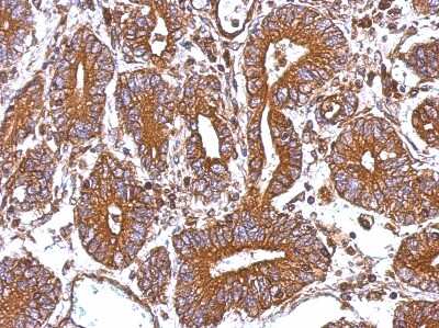 Immunohistochemistry-Paraffin: CTAGE5 Antibody [NBP2-16022]