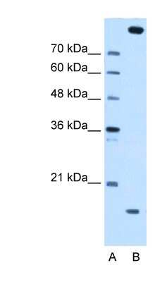 Western Blot: CTAGE5 Antibody [NBP1-62218]