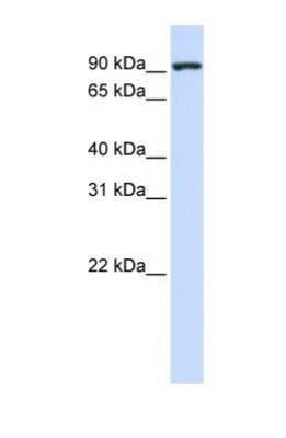 Western Blot: CTAGE5 Antibody [NBP1-69250]