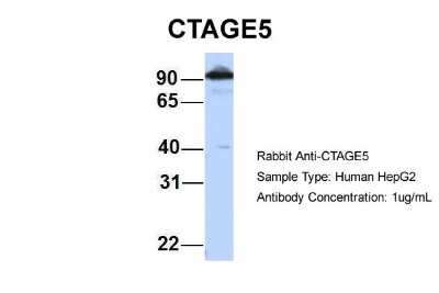 Western Blot: CTAGE5 Antibody [NBP1-69250]