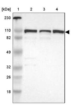 Western Blot: CTAGE5 Antibody [NBP1-85390]