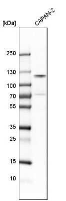 Western Blot: CTAGE5 Antibody [NBP1-85391]