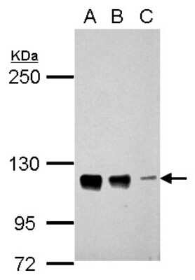 Western Blot: CTAGE5 Antibody [NBP2-16022]