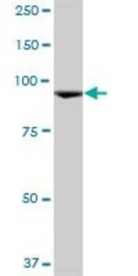 Western Blot: CTAGE6 Antibody [H00340307-B01P]