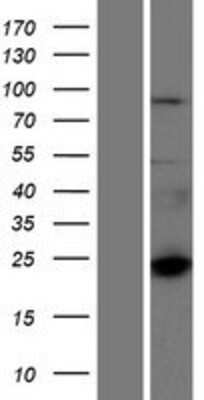 Western Blot: CTAGE6 Overexpression Lysate [NBP2-04952]