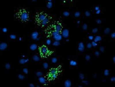 Immunocytochemistry/ Immunofluorescence: CTBP1-DT Antibody (OTI2C6) - Azide and BSA Free [NBP2-72333]