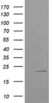 Western Blot: CTBP1-DT Antibody (OTI4F2)Azide and BSA Free [NBP2-72334]