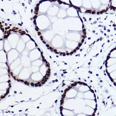 Immunohistochemistry-Paraffin: CTBP2 Antibody (1R1U6) [NBP3-15268]