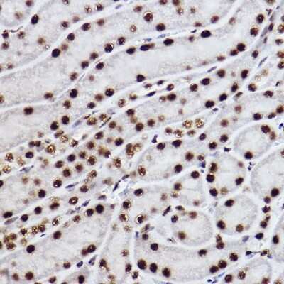 Immunohistochemistry-Paraffin: CTBP2 Antibody (1R1U6) [NBP3-15268]