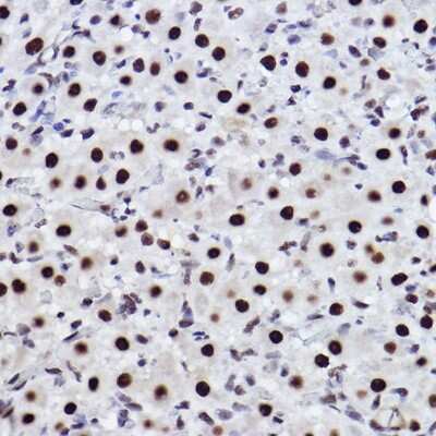Immunohistochemistry-Paraffin: CTBP2 Antibody (1R1U6) [NBP3-15268]