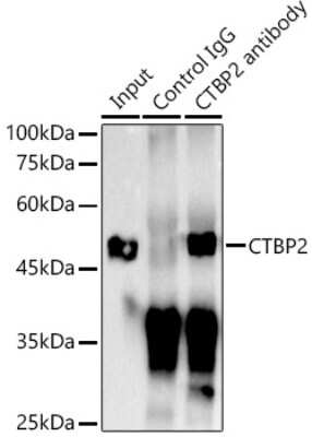 Immunoprecipitation: CTBP2 Antibody (1R1U6) [NBP3-15268]