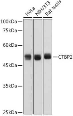 Western Blot: CTBP2 Antibody (1R1U6) [NBP3-15268]