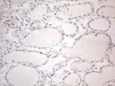 Immunohistochemistry: CTBP2 Antibody (OTI4D4) [NBP2-46390]