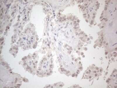 Immunohistochemistry: CTBP2 Antibody (OTI4D4) [NBP2-46390]