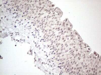Immunohistochemistry: CTBP2 Antibody (OTI4D4) [NBP2-46390]