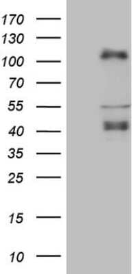 Western Blot: CTBP2 Antibody (OTI4D4) [NBP2-46390]