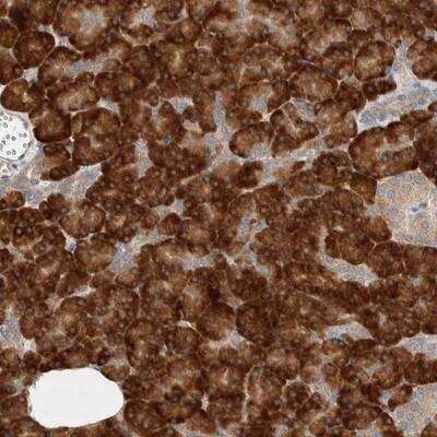 Immunohistochemistry: CTBP2 Antibody [NBP1-87131]