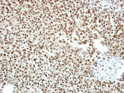 Immunohistochemistry-Paraffin: CTBP2 Antibody [NBP2-16024]