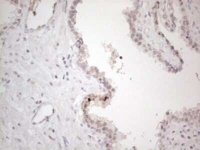 Immunohistochemistry: CTBP2 Antibody (OTI4D4) - Azide and BSA Free [NBP2-70487]