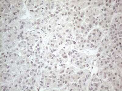Immunohistochemistry: CTBP2 Antibody (OTI4D4) - Azide and BSA Free [NBP2-70487]