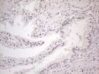 Immunohistochemistry: CTBP2 Antibody (OTI4D4) - Azide and BSA Free [NBP2-70487]