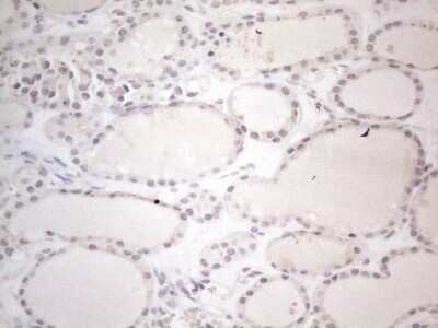 Immunohistochemistry: CTBP2 Antibody (OTI4D4) - Azide and BSA Free [NBP2-70487]