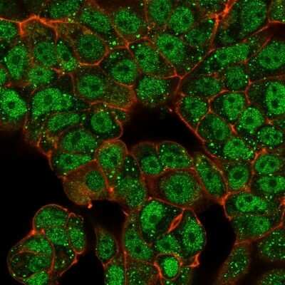 Immunocytochemistry/ Immunofluorescence: CTBP2 Antibody (PCRP-CTBP2-2D11) - C-terminus - Azide and BSA Free [NBP3-08550]