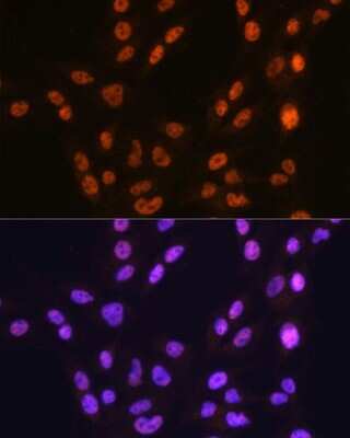 Immunocytochemistry/ Immunofluorescence: CTCF Antibody (4W9B0) [NBP3-15795]
