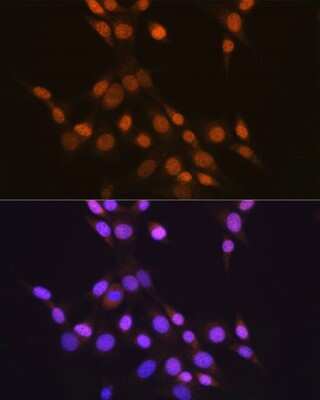 Immunocytochemistry/ Immunofluorescence: CTCF Antibody (4W9B0) [NBP3-15795]