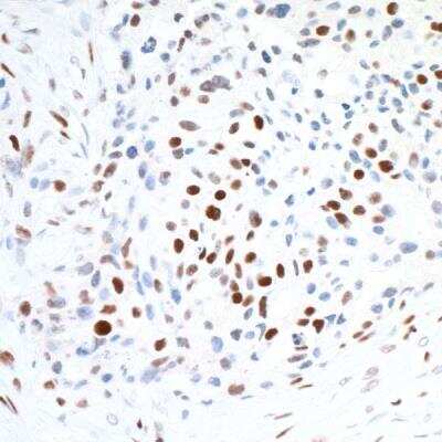 Immunohistochemistry: CTCF Antibody (BLR041F) [NBP2-76420]